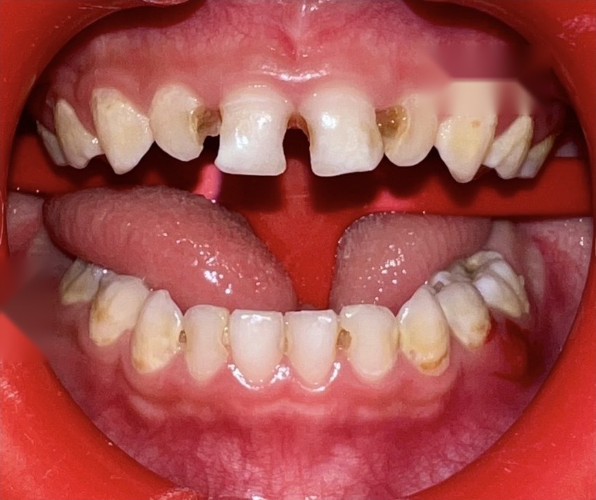 Before treatment